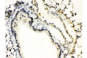 IHC testing of FFPE mouse lung with XBP1 antibody. (XBP1 anticorps)