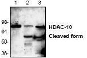 Image no. 1 for anti-Histone Deacetylase 10 (HDAC10) (N-Term) antibody (ABIN127250) (HDAC10 anticorps  (N-Term))