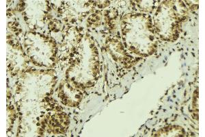 ABIN6273060 at 1/100 staining Human lung tissue by IHC-P. (NOB1 anticorps  (C-Term))