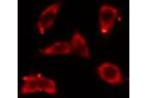 ABIN6276440 staining COLO205 cells by IF/ICC. (ARF6 anticorps  (Internal Region))