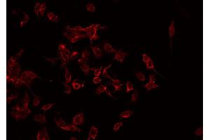 ABIN6268838 staining Hela by IF/ICC. (CMKLR1 anticorps  (Internal Region))