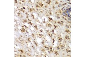 Immunohistochemistry (IHC) image for anti-serum/glucocorticoid Regulated Kinase 1 (SGK1) (AA 172-431) antibody (ABIN3021291)