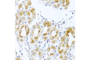 Immunohistochemistry of paraffin-embedded human stomach using TDGF1 antibody. (TDGF1 anticorps)