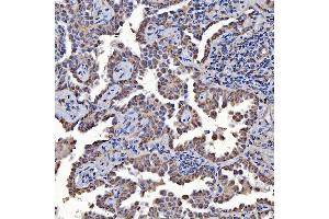 IHC analysis of SARS2 using anti-SARS2 antibody (ABIN7601804). (SARS2 anticorps  (AA 46-518))