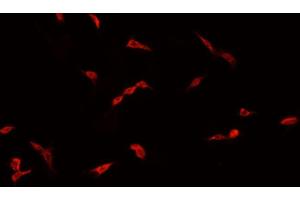 ABIN6267035 staining A549 cells by IF/ICC.