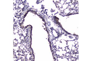 IHC analysis of PDE4D using anti-PDE4D antibody .