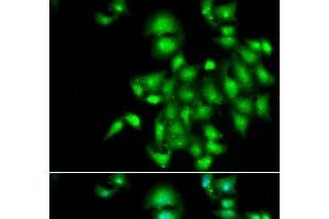 Immunofluorescence analysis of A549 cells using IL20 Polyclonal Antibody (IL-20 anticorps)