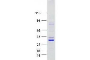 Validation with Western Blot