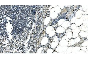 IHC analysis of LSM5 using anti-LSM5 antibody (ABIN7602503).