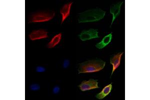 ABIN6259322 and ABIN6274776 staining Hela cells by IF/ICC.