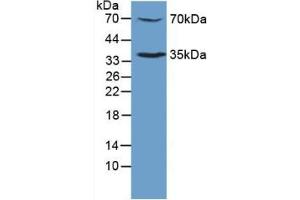 Detection of TPOR in Mouse Sp2/0 Cells using Polyclonal Antibody to Thrombopoietin Receptor (TPOR) (MPL anticorps  (AA 311-460))