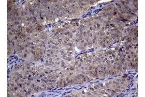 Image no. 1 for anti-Ribonucleotide Reductase M1 (RRM1) (AA 541-792) antibody (ABIN1491583)