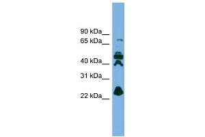 WB Suggested Anti-RPE Antibody Titration: 0. (RPE anticorps  (N-Term))