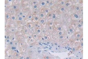 Detection of TFR2 in Human Liver Tissue using Polyclonal Antibody to Transferrin Receptor 2 (TFR2)