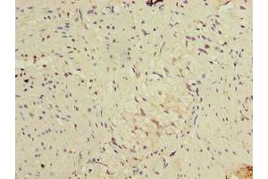 Immunohistochemistry of paraffin-embedded human colon tissue using ABIN7152486 at dilution of 1:100 (BTRC anticorps  (AA 701-1000))