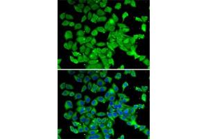 anti-Poly A Specific Ribonuclease (PARN) (AA 1-280) antibody