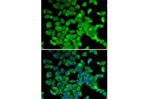 Immunofluorescence analysis of MCF7 cells using PARN antibody (ABIN6129553, ABIN6145230, ABIN6145231 and ABIN6222686). (PARN anticorps  (AA 1-280))