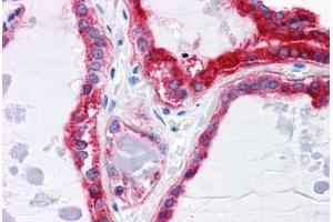 Human Thyroid: Formalin-Fixed, Paraffin-Embedded (FFPE)
