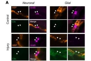 Immunostaining of ankyrin B (AnkB, magenta), MBP (orange), and C3c (green) in Neuronal and Glial injured mice in control and anti-GM1 treated groups. (ANK2 anticorps  (AA 203-496))
