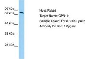 Image no. 1 for anti-G Protein-Coupled Receptor 111 (GPR111) (N-Term) antibody (ABIN6750187) (GP111 anticorps  (N-Term))