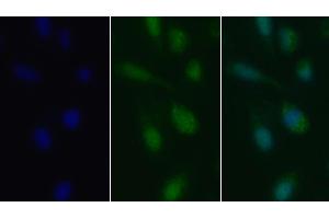 Detection of TGFb1 in Human U2OS cell using Polyclonal Antibody to Transforming Growth Factor Beta 1 (TGFb1) (TGFB1 anticorps  (AA 279-390))