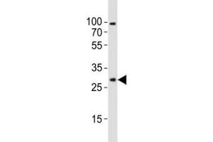 Western blot analysis of lysate from mouse brain tissue lysate using Olig1 antibody diluted at 1:1000.