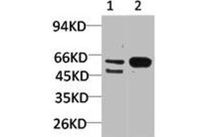 Western blot analysis of 1) Mouse Brain Tissue, 2)Rat Brain Tissue with GABA A Receptor α3 Rabbit pAb diluted at 1:2,000. (GABRA3 anticorps)