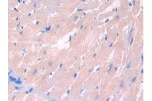 Detection of LCAT in Rat Heart Tissue using Polyclonal Antibody to Lecithin Cholesterol Acyltransferase (LCAT) (LCAT anticorps  (AA 41-210))