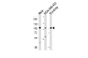 Western blot analysis in Hela,MDA-MB-453 cell line and mouse kidney tissue lysates (35ug/lane).