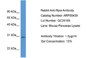 Western Blotting (WB) image for anti-Ribose 5-Phosphate Isomerase A (RPIA) (Middle Region) antibody (ABIN2786211) (Ribose 5-Phosphate Isomerase A (RPIA) (Middle Region) anticorps)