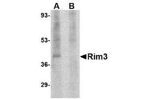 Image no. 1 for anti-Regulating Synaptic Membrane Exocytosis 3 (RIMS3) (N-Term) antibody (ABIN1495404) (RIMS3 anticorps  (N-Term))