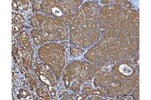 IHC analysis of IMPDH2 using anti-IMPDH2 antibody (ABIN7603063).