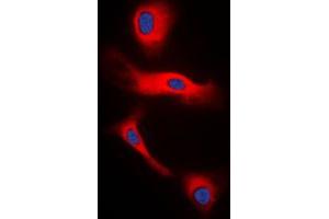 Immunofluorescent analysis of Glucagon staining in H9C2 cells.