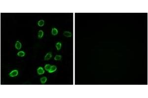 Immunofluorescence analysis of A549 cells, using ATP5G3 Antibody. (ATP5G3 anticorps  (AA 1-50))