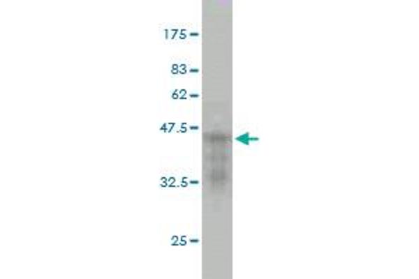 CDKL5 anticorps  (AA 722-831)