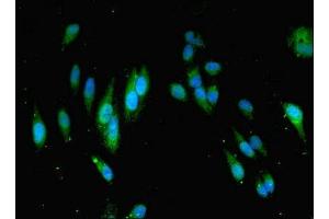 Immunofluorescent analysis of Hela cells using ABIN7160136 at dilution of 1:100 and Alexa Fluor 488-congugated AffiniPure Goat Anti-Rabbit IgG(H+L)