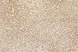 IHC analysis of GUSB using anti-GUSB antibody (ABIN7599854).