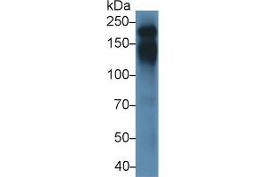 Detection of CD45 in Mouse Thymus lysate using Polyclonal Antibody to Protein Tyrosine Phosphatase Receptor Type C (CD45) (CD45 anticorps  (AA 371-556))