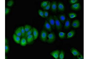 Immunofluorescent analysis of A549 cells using ABIN7170798 at dilution of 1:100 and Alexa Fluor 488-congugated AffiniPure Goat Anti-Rabbit IgG(H+L) (STOML1 anticorps  (AA 79-290))