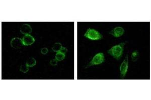 Immunofluorescence staining of methanol-fixed MCF-7 and HepG2 cells showing membrane and cytoplasmic localization. (TYRO3 anticorps)