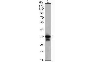 Western Blot showing CDC2 antibody used against Jurkat (1) cell lysate. (CDK1 anticorps)