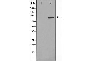 Western blot analysis on COLO cell lysate using CDK11 Antibody,The lane on the left is treated with the antigen-specific peptide.