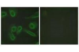 Immunofluorescence analysis of HeLa cells, using PECAM-1 (Ab-713) antibody.