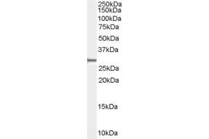 Western Blotting (WB) image for anti-Family with Sequence Similarity 107, Member B (FAM107B) (Middle Region) antibody (ABIN2774503) (FAM107B anticorps  (Middle Region))