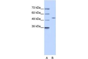 WB Suggested Anti-ZNF555 Antibody Titration:  0. (ZNF555 anticorps  (N-Term))