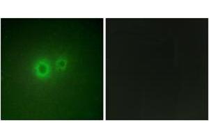 Immunofluorescence analysis of HuvEc cells, using LRAT Antibody.