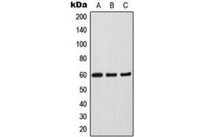 Western blot analysis of SOX11 expression in HepG2 (A), HeLa (B), SP2/0 (C) whole cell lysates. (SOX11 anticorps  (N-Term))