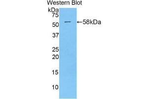 Western Blotting (WB) image for anti-Myxovirus Resistance Protein 1 (MX1) (AA 400-652) antibody (ABIN1859914) (MX1 anticorps  (AA 400-652))