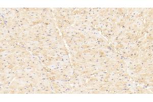 Detection of MYLK3 in Human Cardiac Muscle Tissue using Polyclonal Antibody to Myosin Light Chain Kinase 3 (MYLK3)