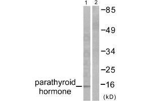 Western blot analysis of extracts from A549 cells, using Parathyroid Hormone antibody (ABIN5976482). (PTH anticorps  (Internal Region))